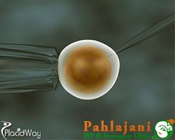 Slider image (8) Pahlajani IVF Clinic